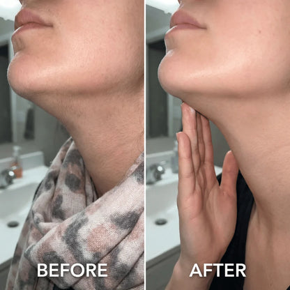 Cyperus Rotundus Skin Serum - Stop Unwanted Hair Growth Naturally - 100% Real